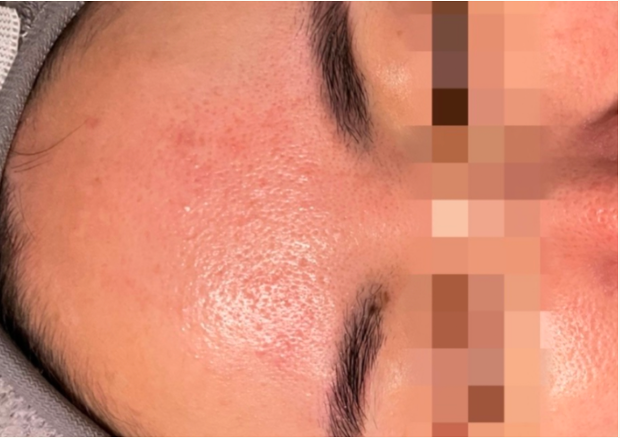 清潭洞高分子SPA水庫管理 Cheongdam-dong Hydrating SPA Management