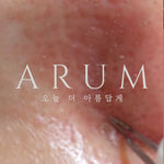 針清管理